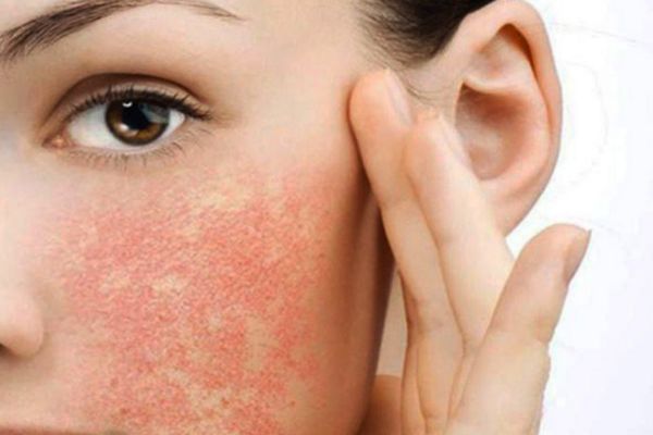 da mong yeu nhay cam