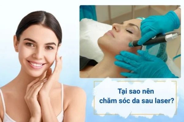vi sao can cham soc sau laser