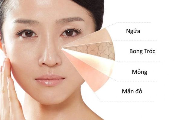 dau hieu cho thay hang rao da bi ton thuong