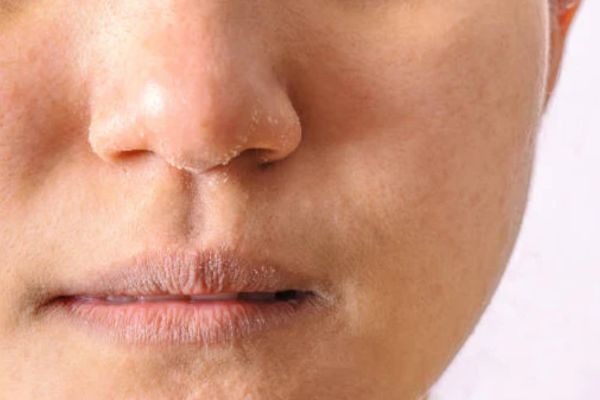 dau hieu da thieu nuoc thuong gap