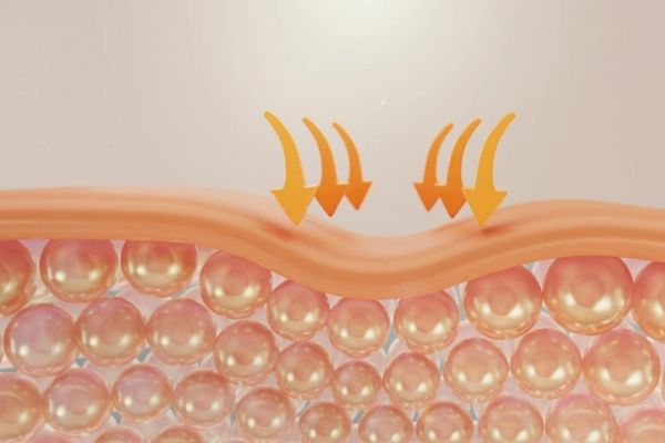 nhung cau hoi thuong gap ve hang rao lan da