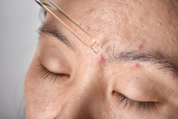 nhung luu y quan trong khi dung serum