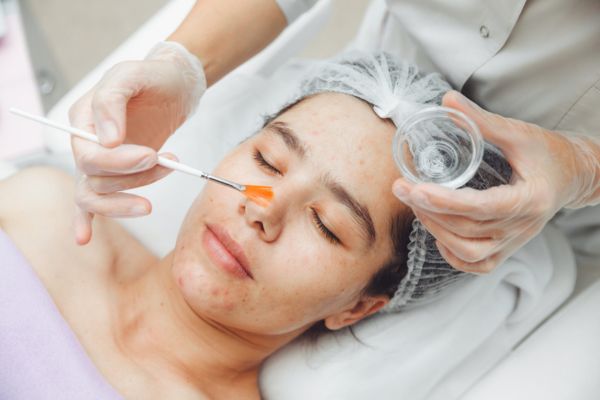 serum b5 co tot cho da peel khong