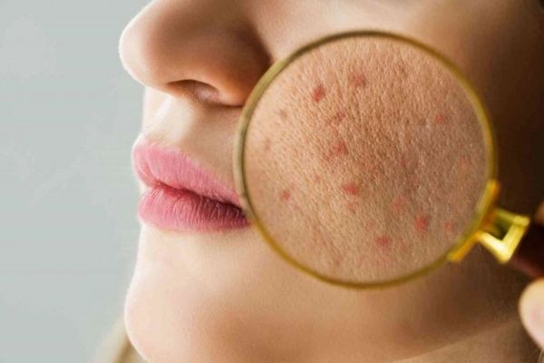 nguyen nhan lam hang rao da bi ton thuong